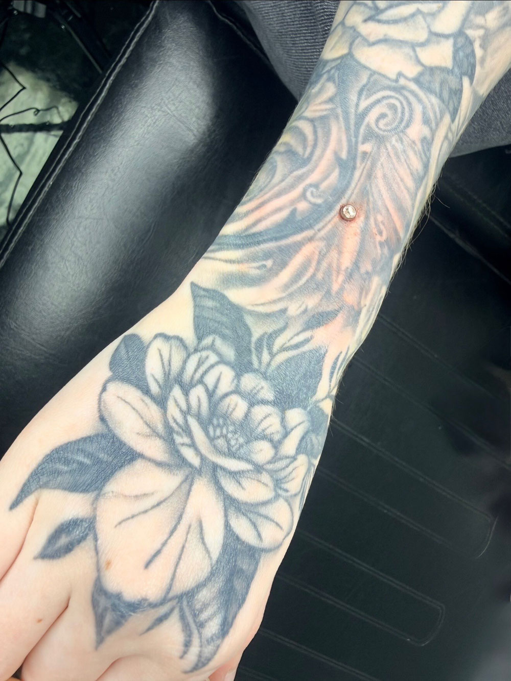 Dermal Arm Piercing
