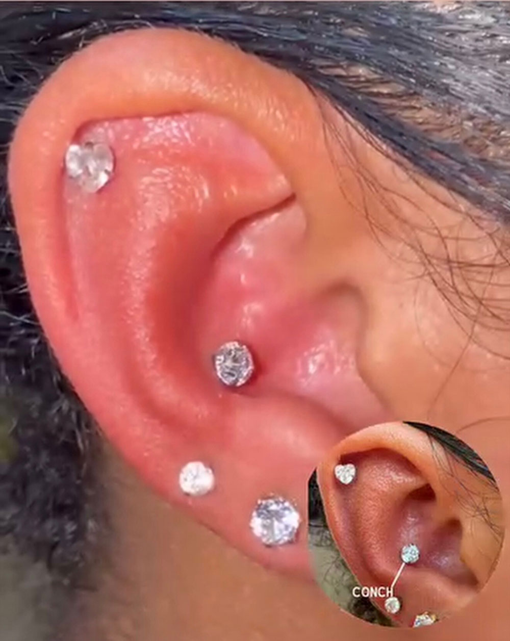 Example of a conch ear piercing